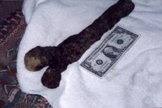 116_femur.jpg